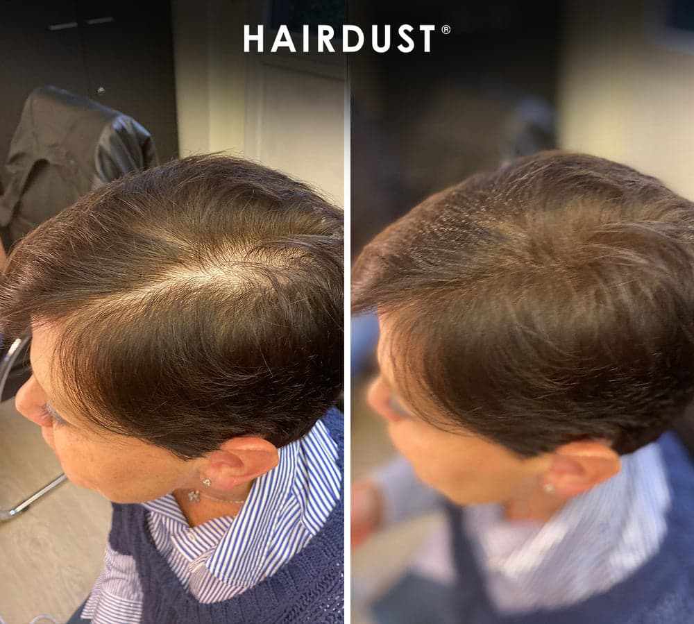 Prima e dopo HAIRDUST - copertura del diradamento